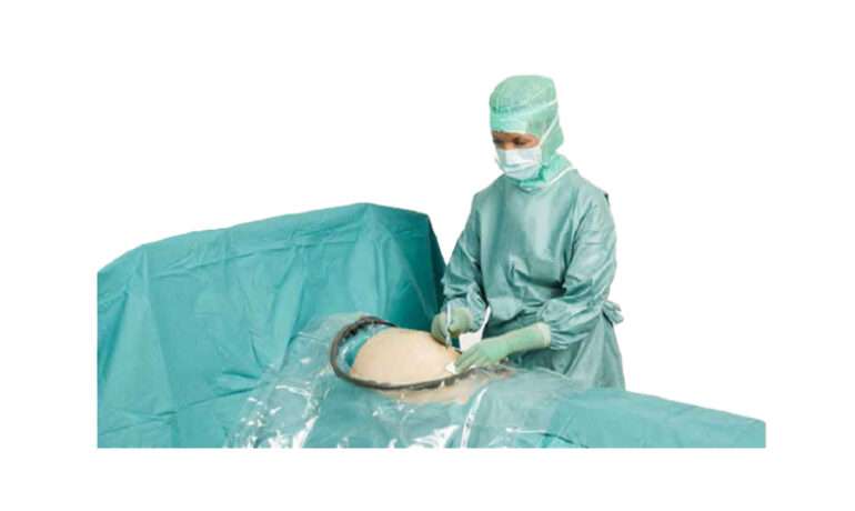 BARRIER-obstetric-drapes